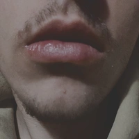 Dubbi