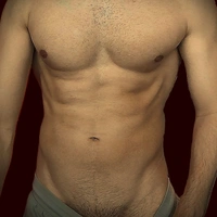 Marco002