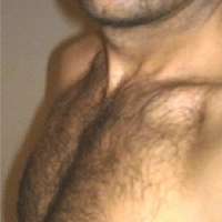 nazalodi