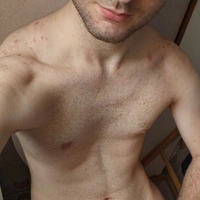 Aaron10